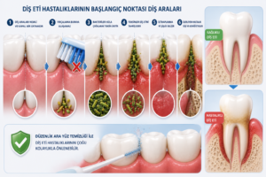 2. Diş Eti Hastalıklarının Başlangıç Noktası Diş Aralarıdır