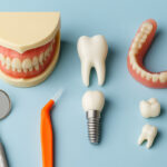 Protetik Diş Tedavisi