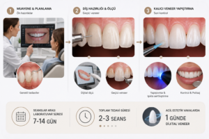 Laminate Veneer Ne Kadar Sürer