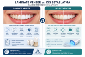 Veneer vs. Diş Beyazlatma