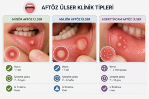 Aftöz Ülser Klinik Tipleri Nelerdir