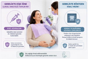Hamilelikte Diş Tedavisi Nasıl Yapılır ve Güvenli Midir? 6 Gebelikte dişe iğne (lokal anestezi) yapılır mı ve röntgen riskli midir