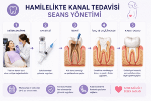 Hamilelikte Diş Tedavisi Nasıl Yapılır ve Güvenli Midir? 11 Hamilelikte kanal tedavisi seans yönetimi