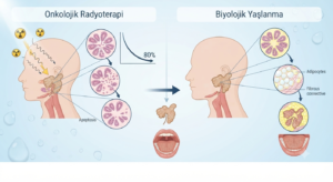 Ağız kuruluğu (kserostomi) nedir ve nasıl tedavi edilir? 4 Radyoterapi ve yaşlanmaya bağlı faktörler (2)