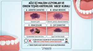 Ağız içi malign lezyonlar ve erken teşhis kriterleri