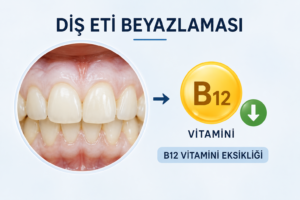 Diş eti beyazlaması hangi vitamin eksikliğidir