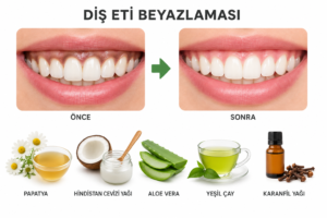 Diş eti beyazlaması nasıl geçer ve evde hangi bitkisel çözümler uygulanır