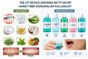 Diş eti beyazlamasına ne iyi gelir ve hangi tıbbi gargaralar kullanılmalıdır