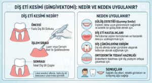Diş eti kesimi nedir ve neden uygulanır