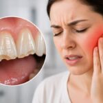 Diş minesinin aşındığı nasıl anlaşılır sorusunun görsel yanıtı olan; ön dişlerin uçlarında şeffaflaşma, sararma ve dentin sızlaması belirtilerini gösteren anatomik görsel.