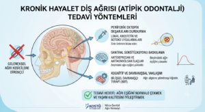 Kronik Hayalet Diş Ağrısı Tedavisi İçin Hangi Yöntemler Uygulanır