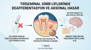 Trigeminal Sinir Liflerinde Deafferentasyon ve Aksonal Hasar