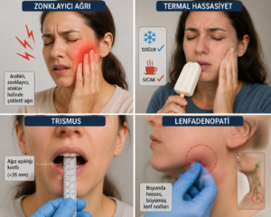 Zonklayıcı ağrı, termal hassasiyet, trismus ve lenfadenopati (2)