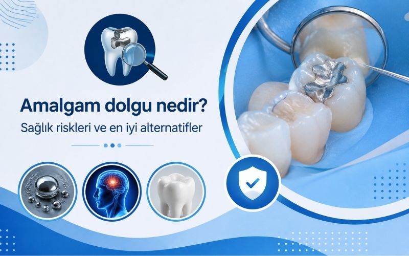 Amalgam dolgu nedir, diş çürüğü tedavisinde metal dolguların yapısı ve sağlıklı diş dolgusu alternatiflerini anlatan görsel.