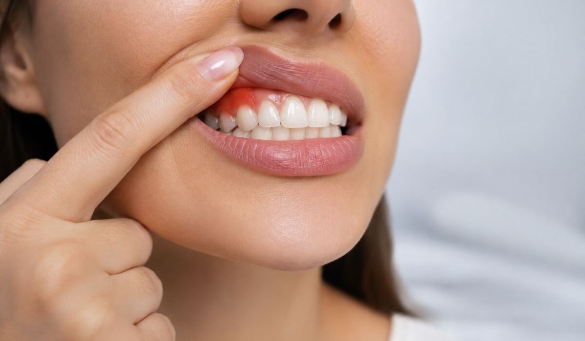 Diş eti çekilmesi evreleri ve hassasiyet belirtilerini parmağıyla gösteren hasta