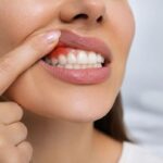 Diş eti çekilmesi evreleri ve hassasiyet belirtilerini parmağıyla gösteren hasta