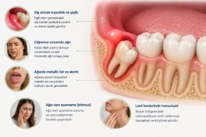 Yirmilik diş iltihabı belirtilerini gösteren anatomik görsel; diş eti şişliği, çiğneme ağrısı, ağız açmada zorluk ve lenf bezi hassasiyeti