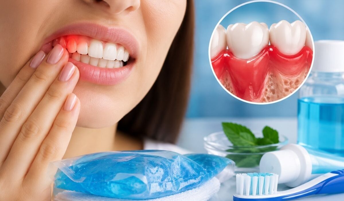 Diş eti ağrısı ne iyi gelir konusu için iltihaplı diş eti anatomisi ve ağız bakım ürünleri