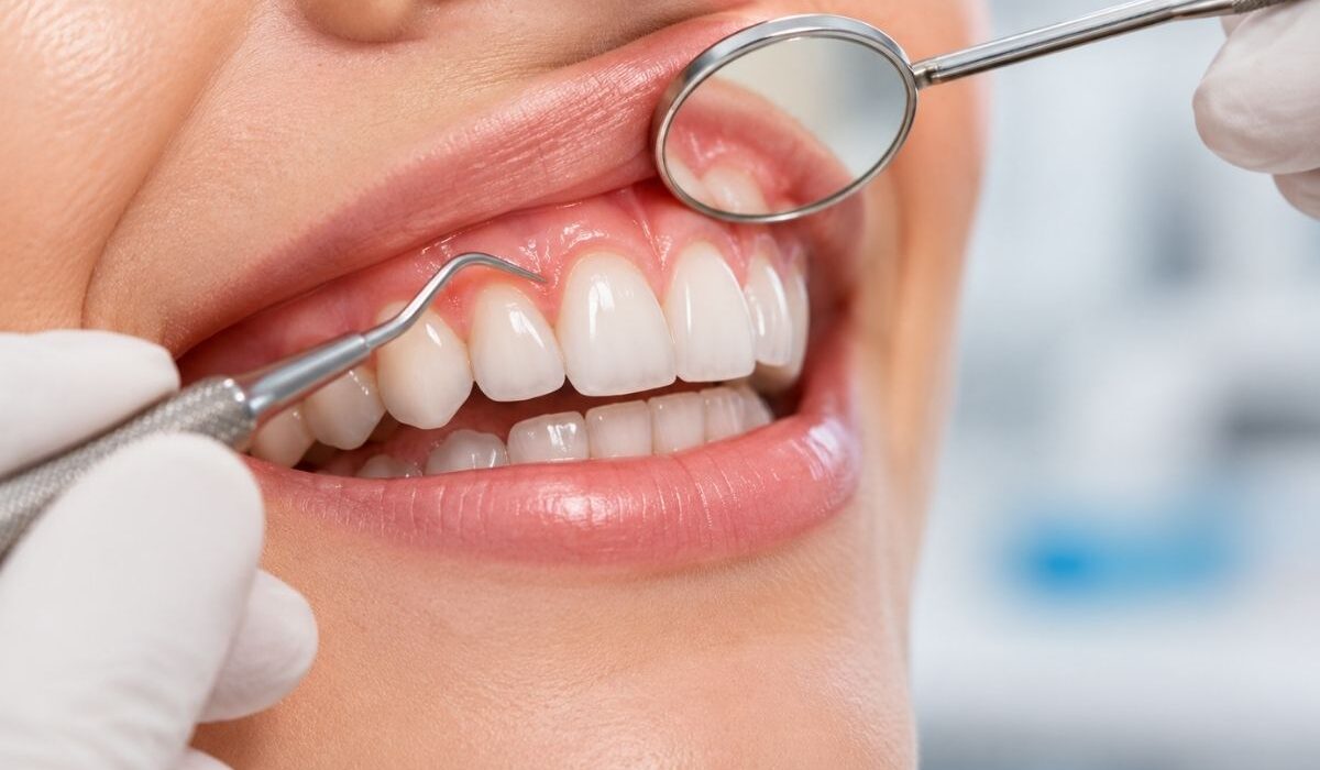 Gingival nedir ve sağlıklı diş eti yapısının diş hekimi tarafından muayenesi