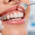 Gingival nedir ve sağlıklı diş eti yapısının diş hekimi tarafından muayenesi